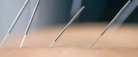 Alumno recibiendo formación en Acupuntura. Titulación y mejora del bienestar.